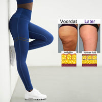 Anti-Cellulitis Compressielegging Voor Dames - SculptFit