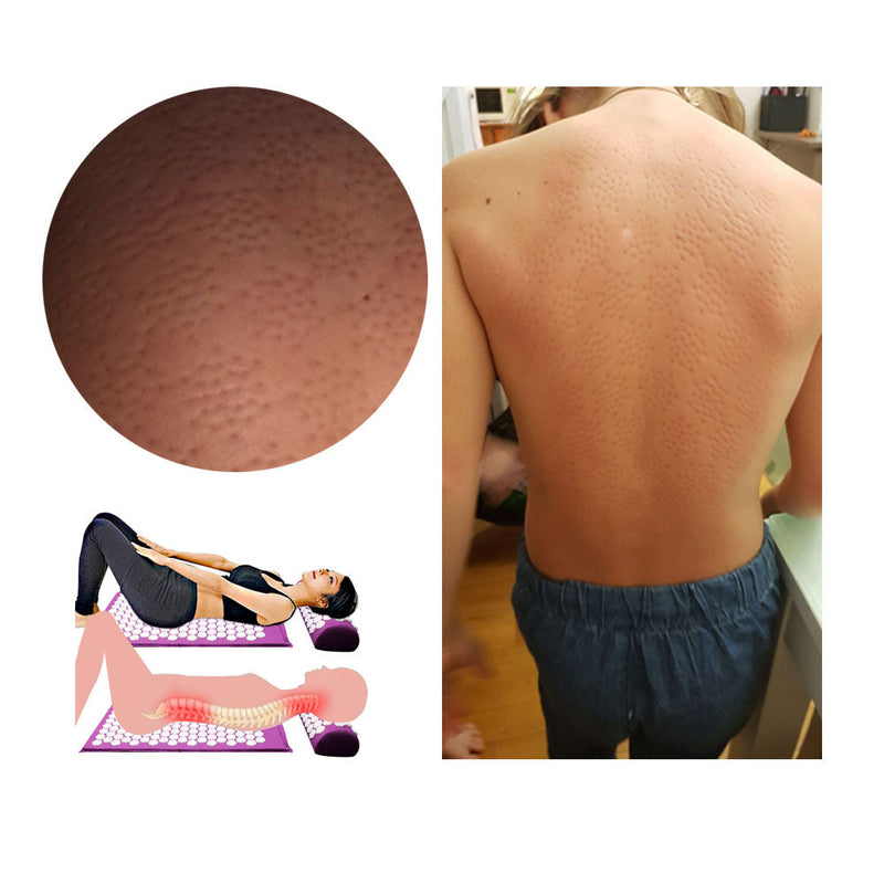 Acupressuur Yogamat & Kussenset - RelaxMat