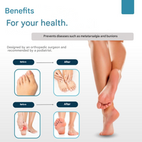 Therapeutische Teenenspreiders met Kussenpads – Podiora
