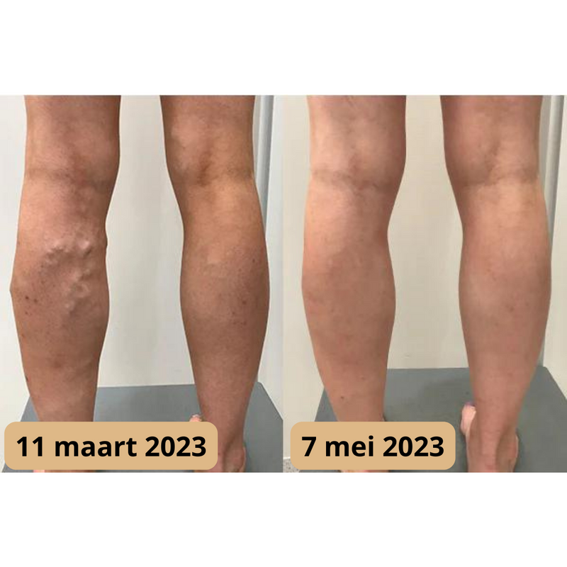 Voetmassage Mat - AcupressureFlow
