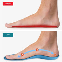 Orthopedische Inlegzolen – StepRelief