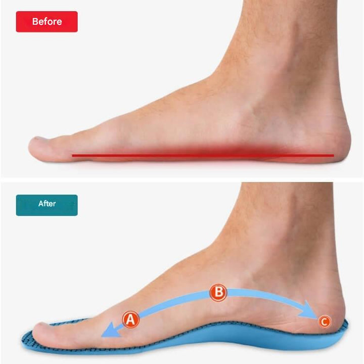 Orthopedische Inlegzolen – StepRelief