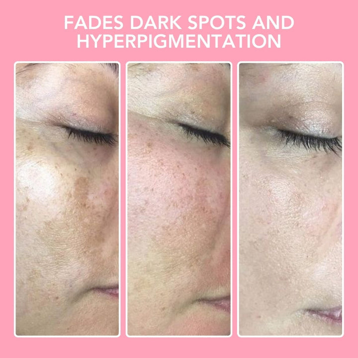 Kurkuma Kojiczuur Reinigingspads - GlowTonic