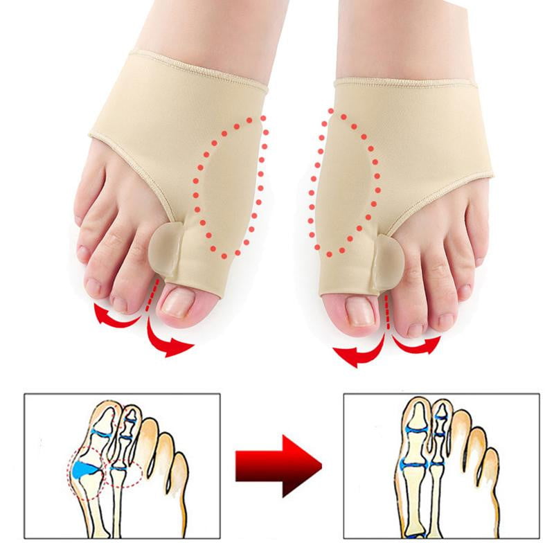 Hallux Valgus Beschermer (1 paar) - OrthoBunion