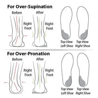 Comfortabele Orthopedische Dames Zomerschoenen – Tessa